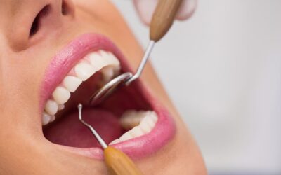 Dentiste et hygiène : les gestes et équipements pour une pratique irréprochable